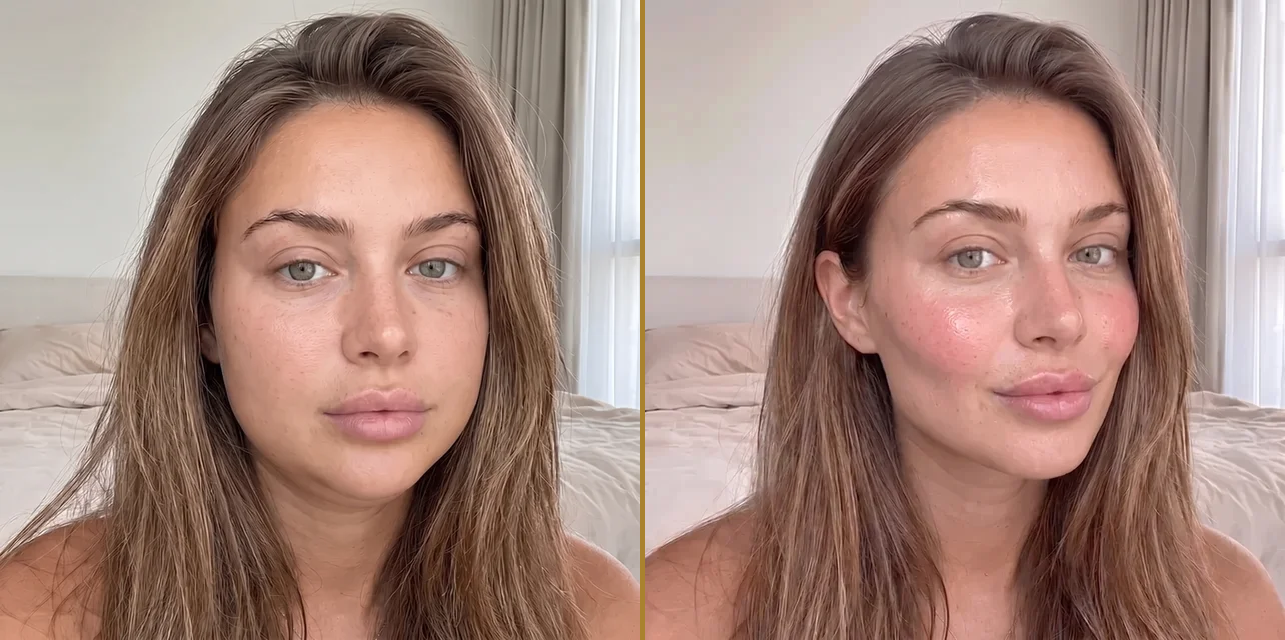 before and after